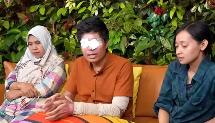 Sempat Buta karena Air Keras, Agus Kini Bisa Melihat Lagi